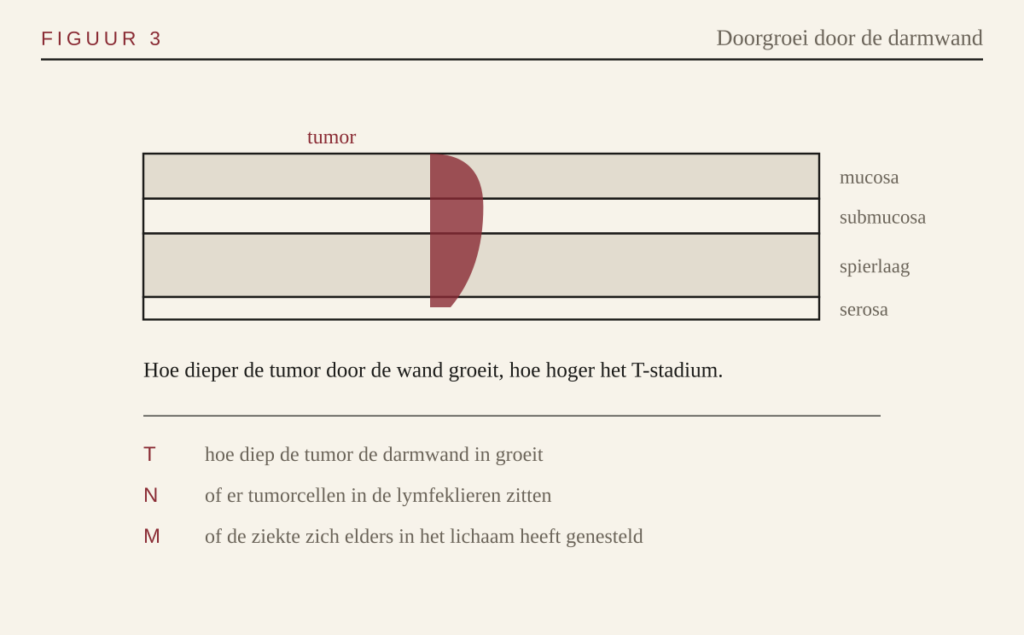 Schema van de darmwandlagen met doorgroei van een tumor